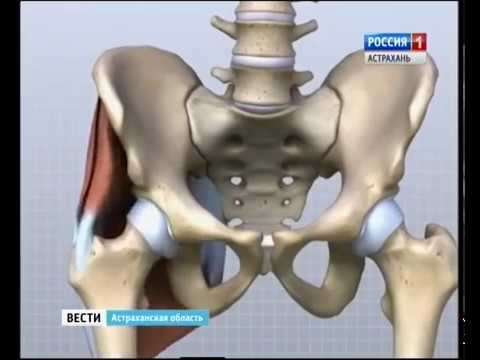 Video: Krakovyak Nima?