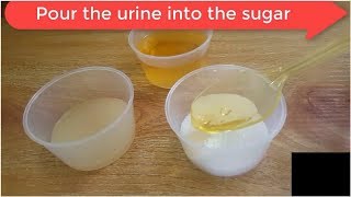 DIY Sugar Home Pregnancy Test: How It Works — or Doesn’t | Tita TV