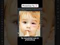 Clone Tools | Photoshop Tutorials | #photoshoptutorials #photoshop