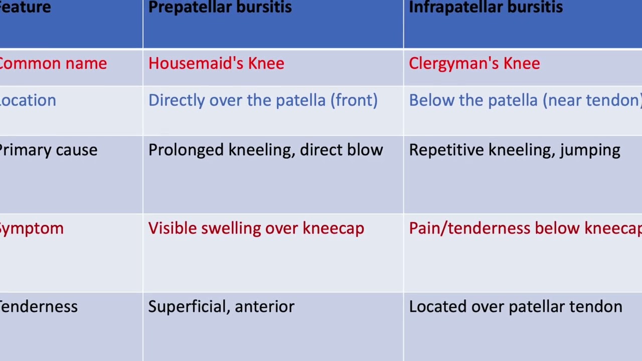Prepatellar bursitis, Housemaid knee, knee injury, sports injuries 