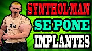 Cambia El Synthol Por Implantes De Silicona - Kirill Tereshin El Hulk Ruso
