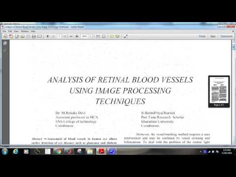 ANALYSIS OF RETINAL BLOOD VESSELS USING IMAGE PROCESSING TECHNIQUES