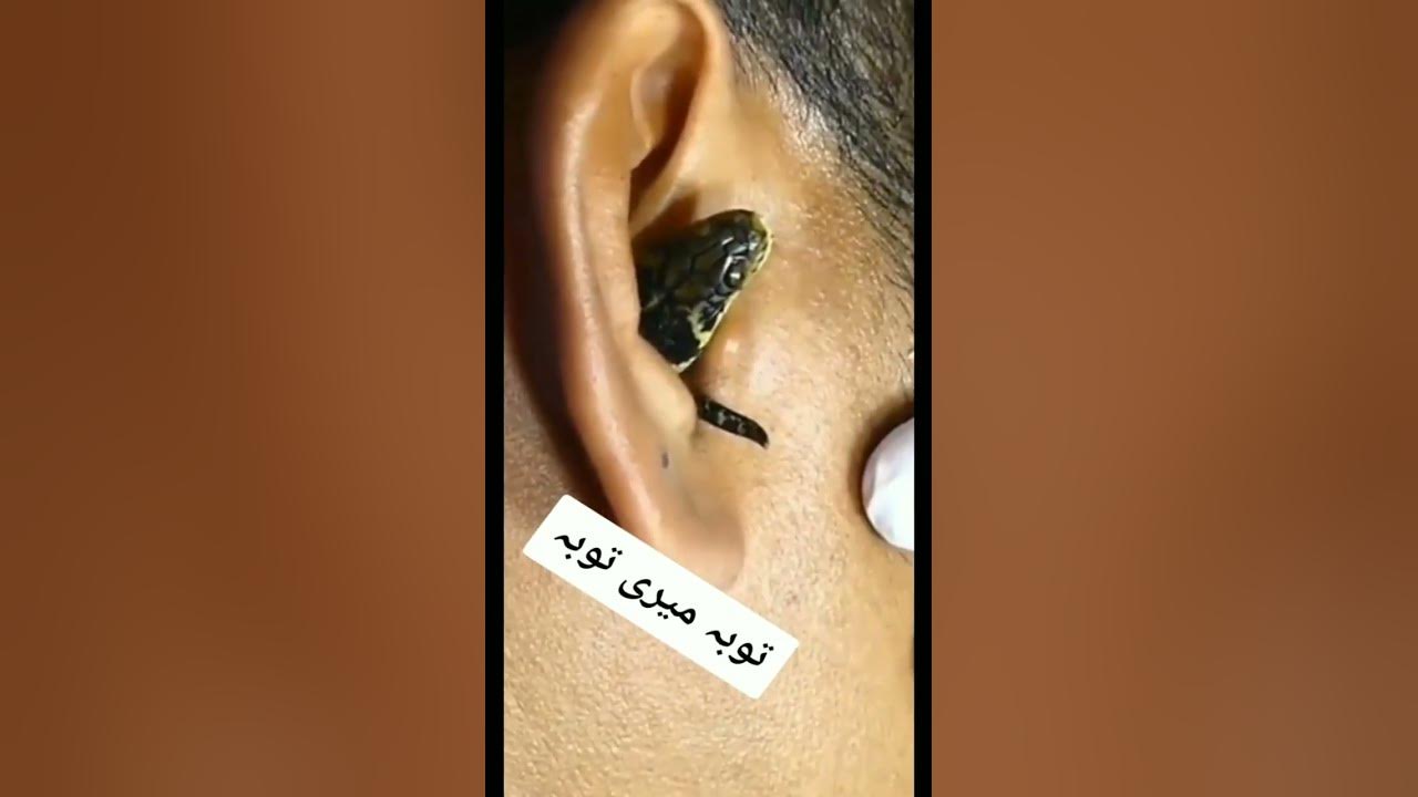 Snake in ear 👂 - YouTube