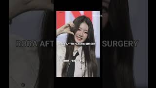 Rora Before Plastic Surgery