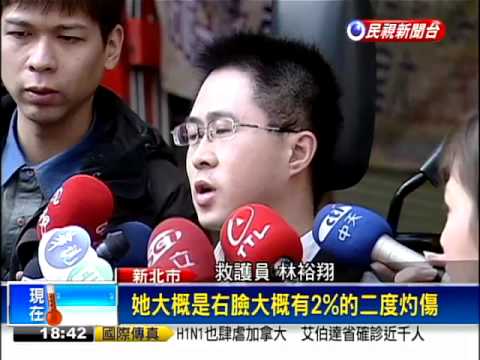 小火鍋添酒精膏 女工讀生險毀容－民視新聞