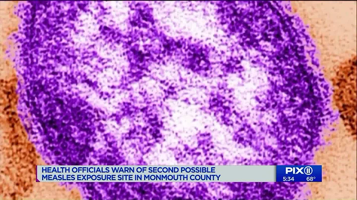 Newly reported NYC measles cases push US tally to highest mark in 25 years