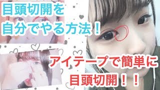 蒙古襞のない ある人の違い 見分け方 自力で切る方法 芸能人診断 Carat Woman