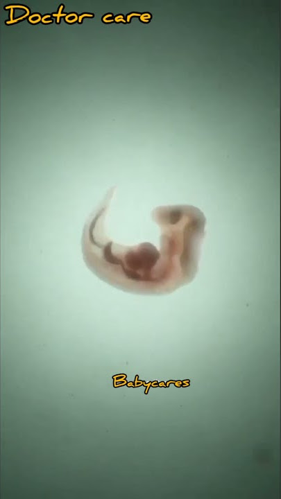After Having Sex | Pregnancy Times | See how the baby is made in the mother's womb | Babycares