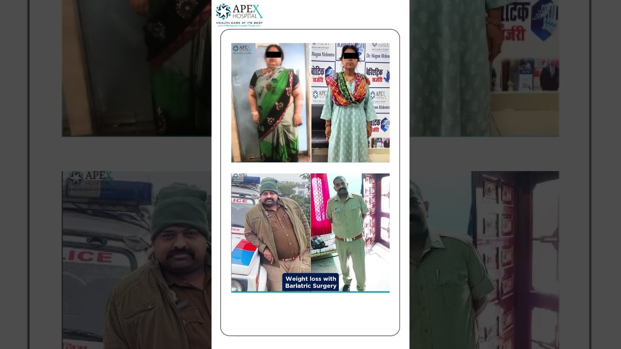 Does bariatric Surgery has any side effects?  