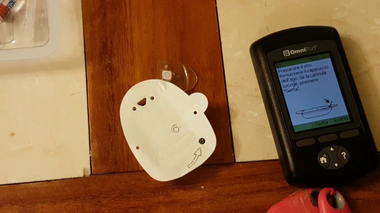 Come mettere il microinfusire omnipod diabete tipo 1