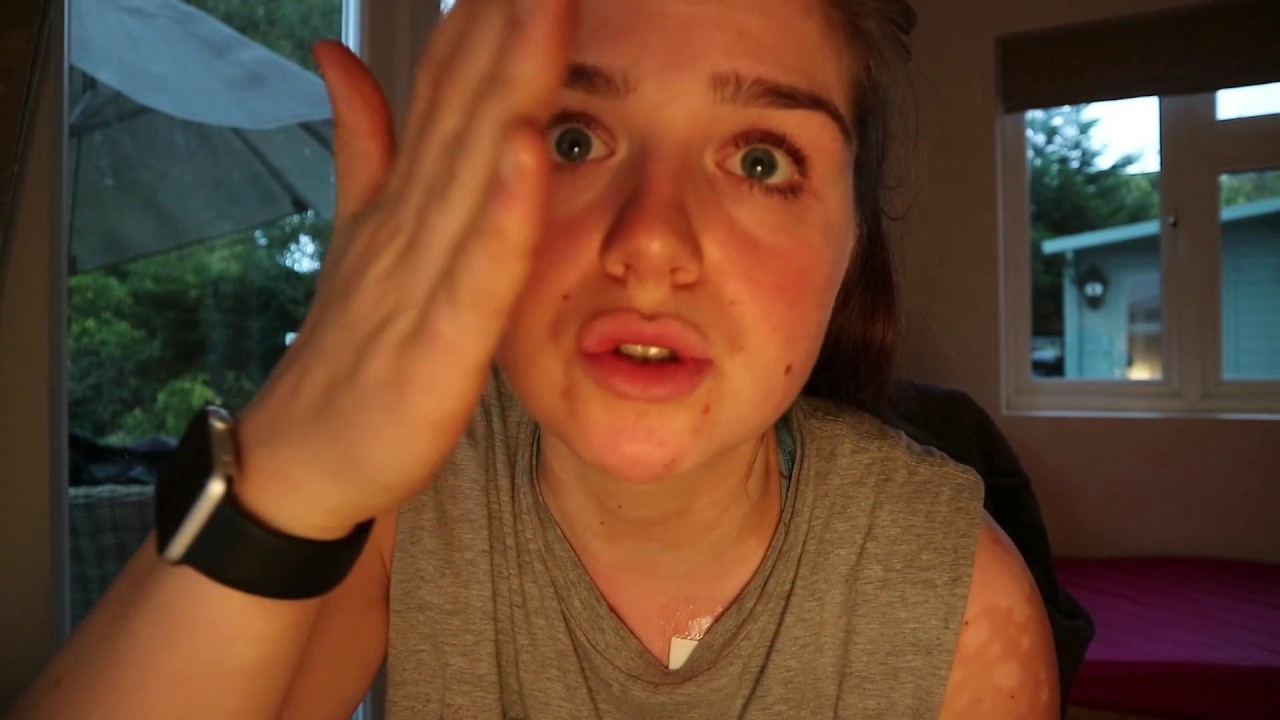 CT RESULTS | TUMOUR REMOVAL