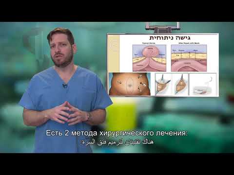 07 תיקון בקע טבורי   האיגוד הכירורגי של ההסתדרות הרפואית בישראל