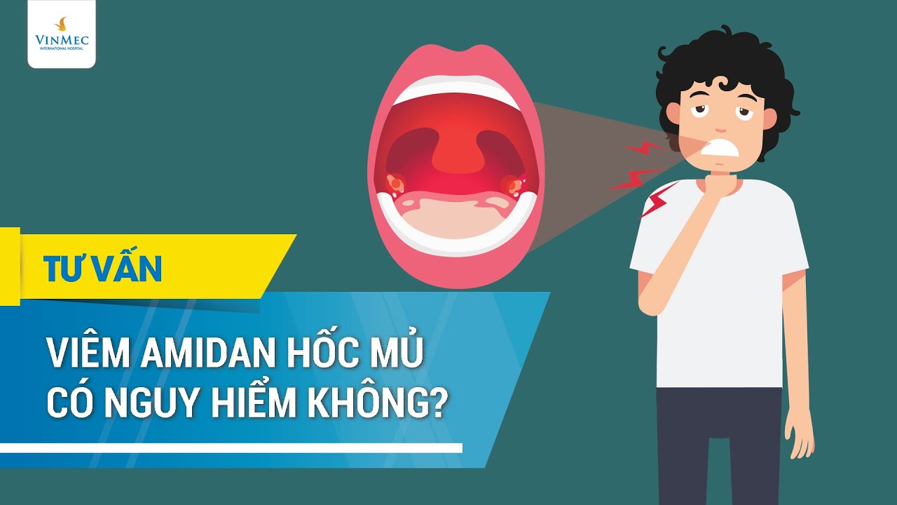 Viêm amidan hốc mủ có nguy hiểm không? - youtube
