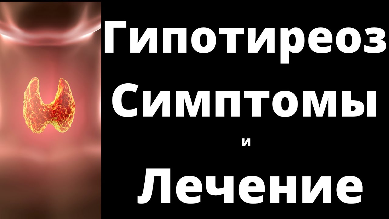 Гипотиреоз Симптомы и Лечение. Гипотиреоза без ВСД не бывает. Устраните ...