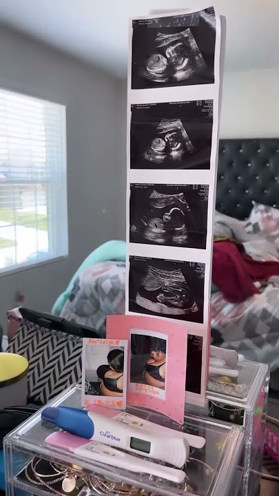 Excited for the Journey Ahead #girlmom #octoberbaby