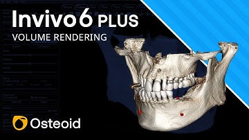 Invivo6 Plus – Volume Rendering_Project to 2D