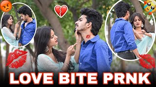 LOVE BITE PRANK 🙈😘|| ये क्या किया मैंने💔😭|| Classy Subhash