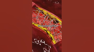 CHOLESTEROL- LDL & HDL|What is cholesterol,good cholesterol & bad cholesterol #cholesterol #ldl #hdl