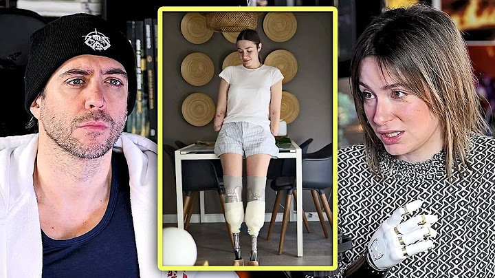 Jordi Wild pregunta a Carla cómo fue la primera vez que se miró al espejo después de la amputación