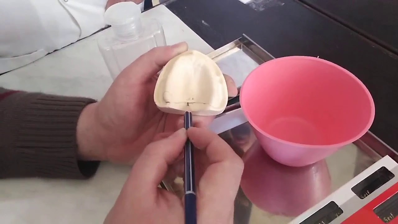 تعويضات متحركة عملي (1) || اخذ طبعة اولية (المحاضرة الاولى)