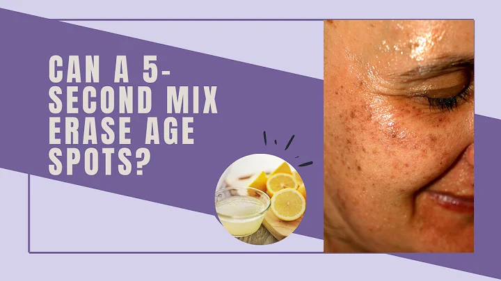 3 Kitchen Ingredients That Erase Age Spots 🥄