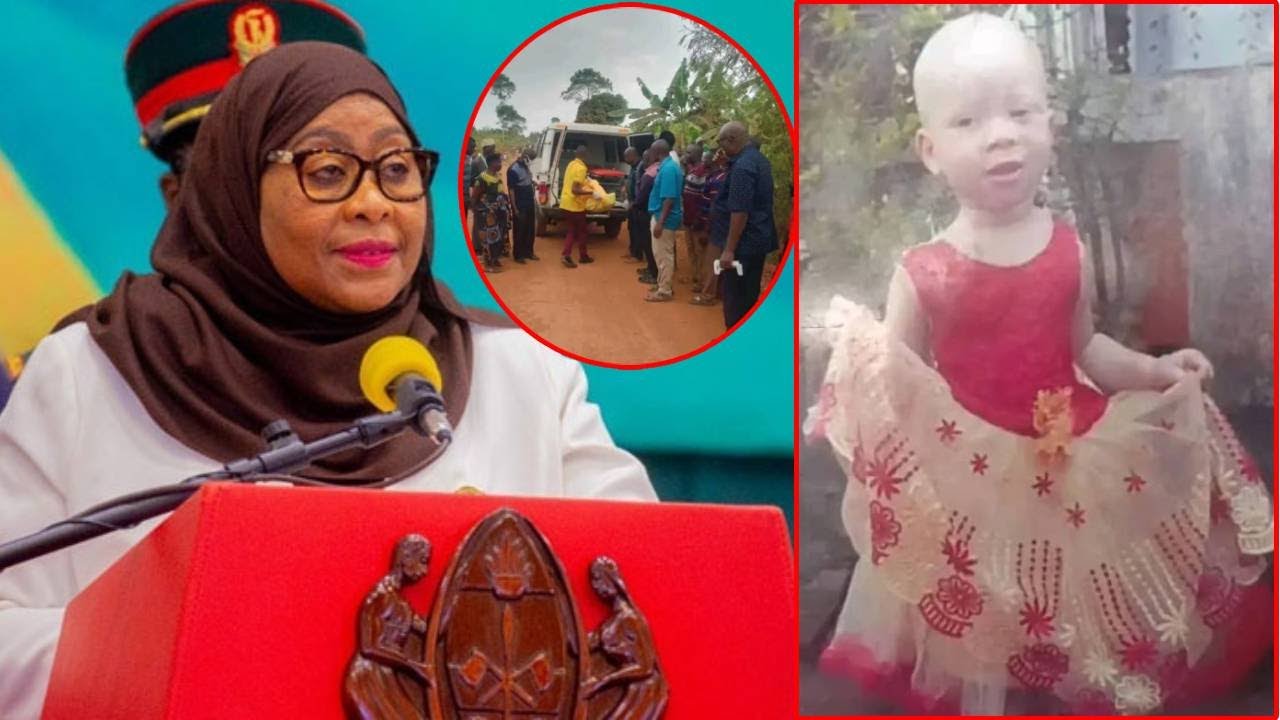 RAIS SAMIA AMLILIA MTOTO ALBINO ALIYEUAWA KIKATILI.