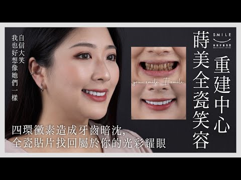 四環黴素黃牙害我超自卑💧全瓷貼片讓你重新擁抱笑容｜蒔美牙醫集團