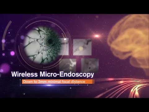Odysight.AI (former ScoutCam) - The World's Smallest Medical Cameras - video from ScoutCam