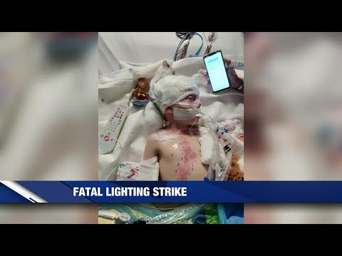 Valley Mills family reflects on lightning strike that claimed father's life, critically injured boy
