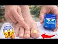 Stop Wasting Money on Nail Treatments Do This Instead!