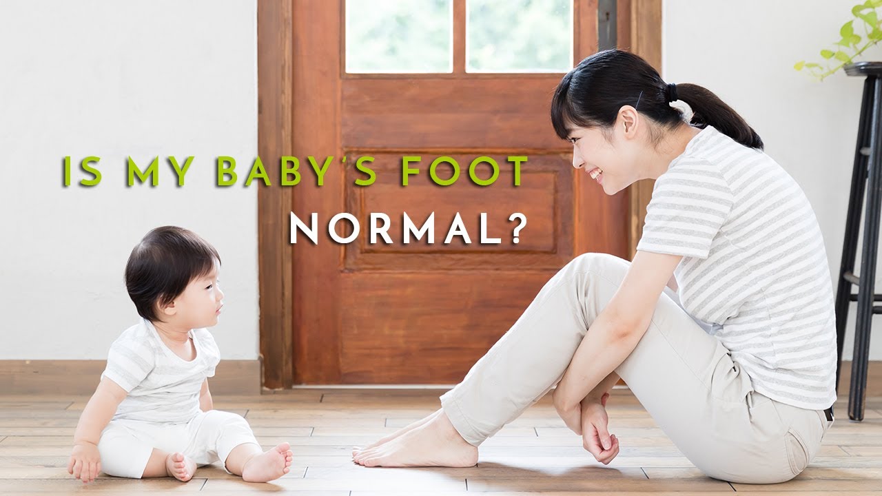 How to recognise if my baby's feet are normal or needs treatment? Clubfoot, baby  feet turning inward or outward