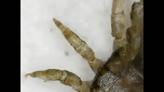 Head Lice Under Microscope 🔬 | Tiny Parasite Filmed From Different Eye (FDE)