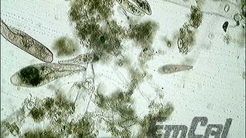 Micro and Macro Video Imaging Systems