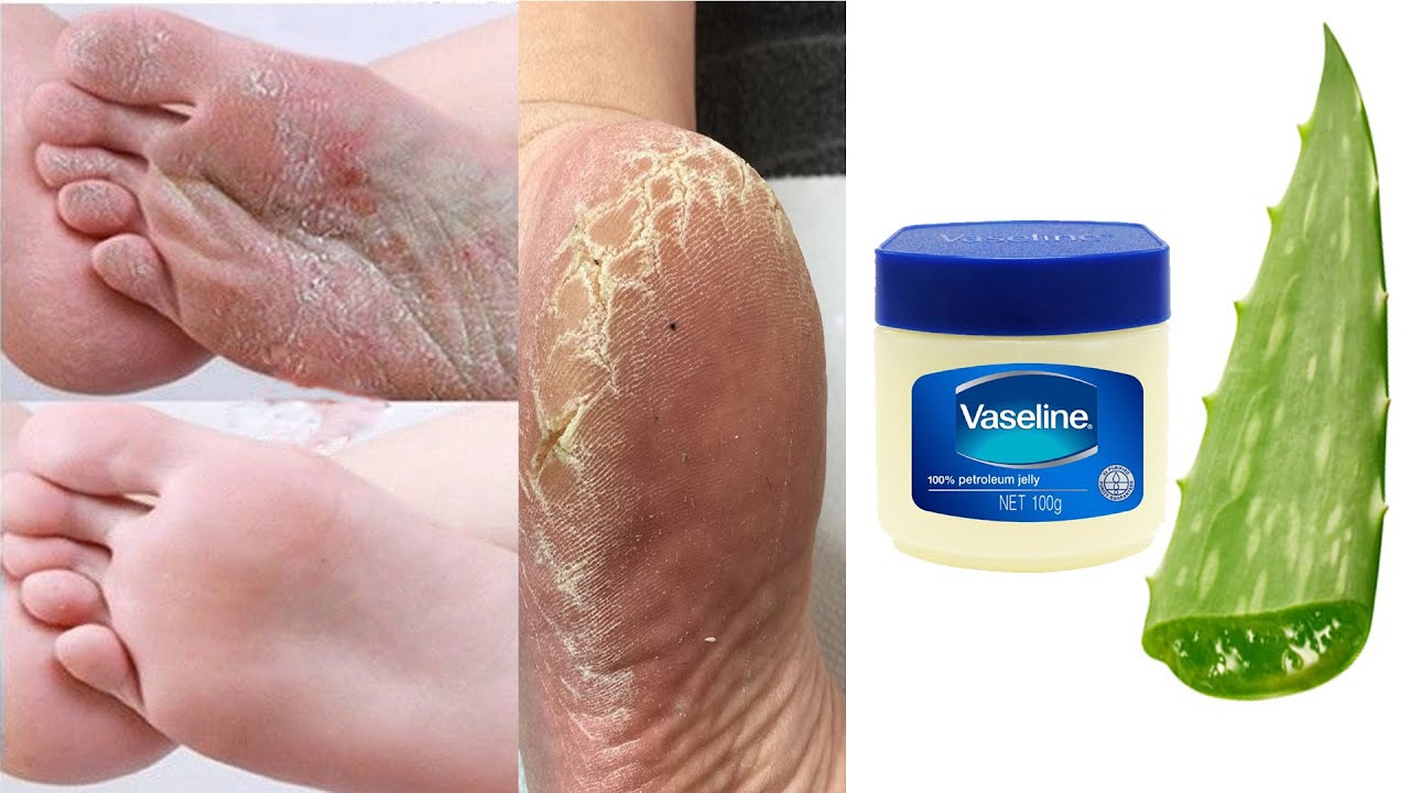 Vaseline Anti-crack Moisture Hand Cream Hands And Foot Moisturizer  Anti-Drying Long Lasting Repair Hand Lotion Skin Care Cream - AliExpress