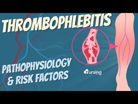 Thrombophlebitis: Pathophysiology & Risk Factors- Nursing thumbnail