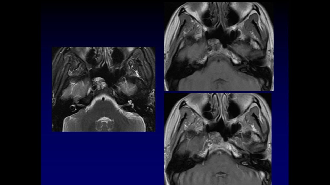 Журнал Клуба: Задержанная пневматизация