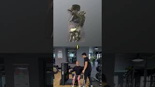 Why the Cobb Angle Doesn't Tell the Whole Story of Scoliosis | SpineX
