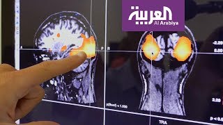 دراسة: آلية عمل الدماغ تختلف بين محبي السهر ومن يستيقظ باكرا