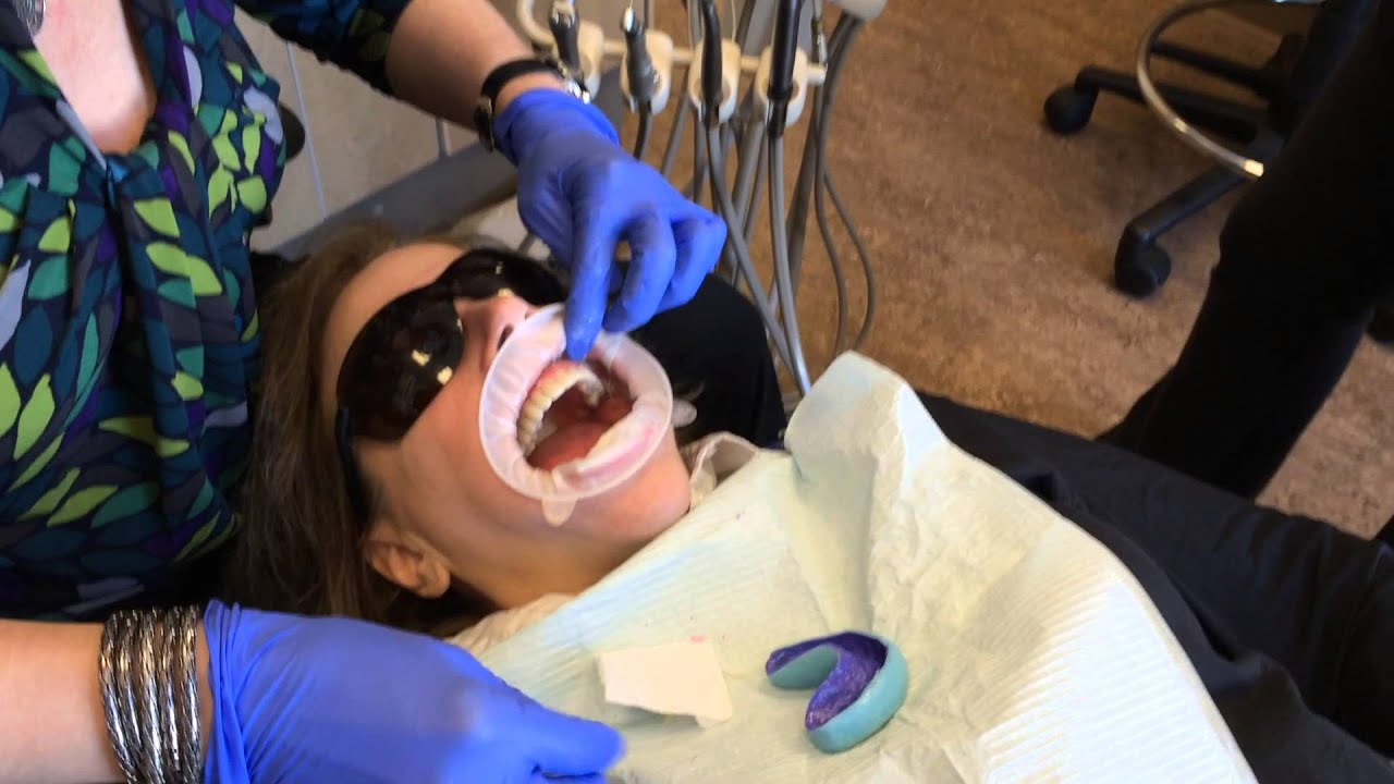 The Magic Begins! Ottawa Makeover Project Participant gets her new trial smile!