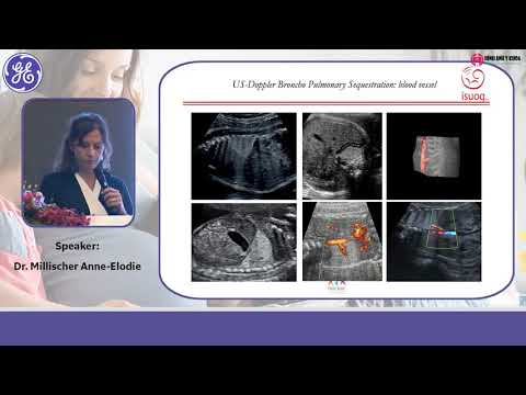 6. Bất thường lồng ngực: Từ siêu âm đến MRI, BS Anne Millischer