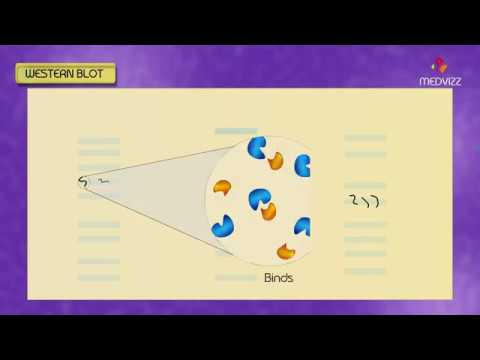 Video: Chức năng của đầu dò trong Southern blot là gì?