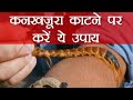 कनखजूरे के काटने पे घबराए नहीं, तुरंत करें ये घरेलु उपाय, Centipede Bite -Home Remedies | Boldsky