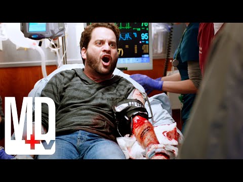 Man Tries to Cut Off His Own Arm | Chicago Med | MD TV