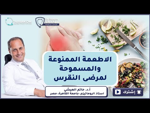 الاطعمة الممنوعة والمسموحة لمرضى النقرس