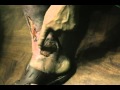 ulceras varicosas pie diabetico varices gangrena cura remedio casero uriel tapia