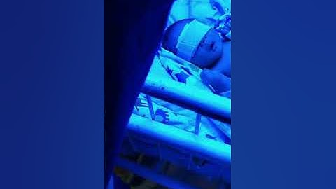 Fototherapy Bayi Kuning RSWK Kuningan