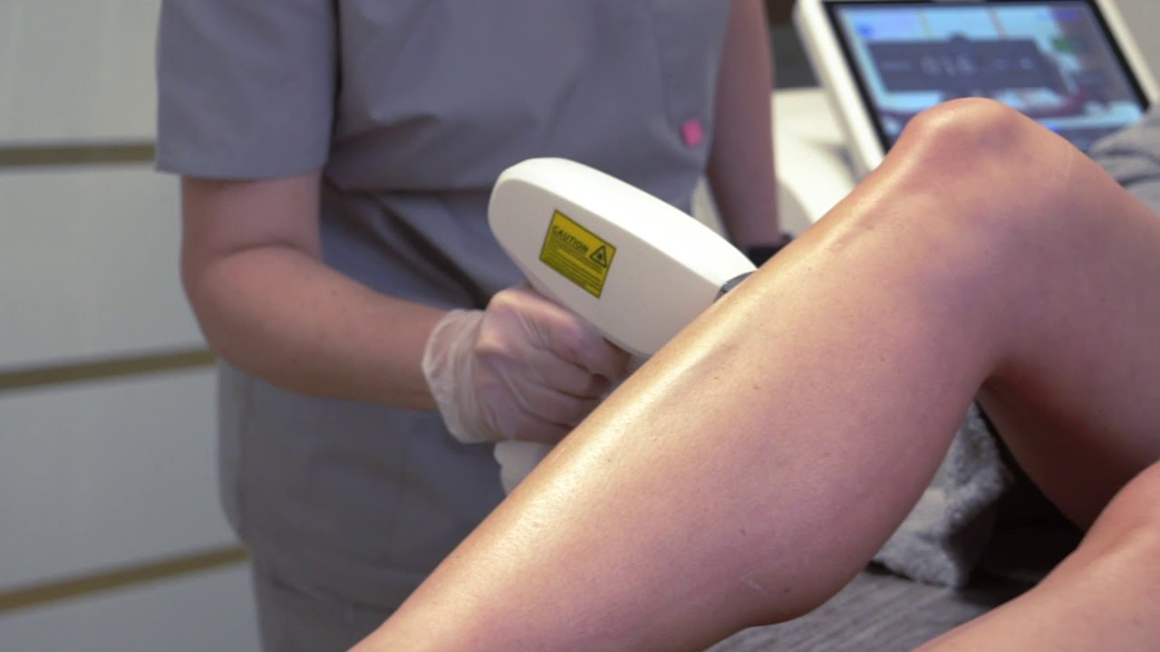 Лазерная эпиляция диодным лазером в Москве - YouTube