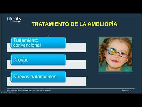 Vídeo: Onde a ambliopia afeta?