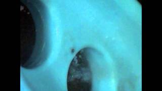 Bullet Resistance and Anti Ballistic testing of Polymers