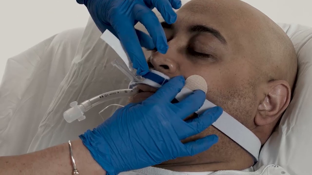 Mise en place - Dispositif de fixation pour sonde d'intubation BREEZELOCK